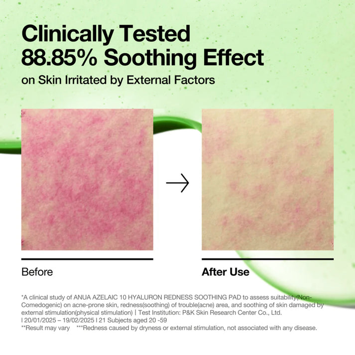 Anua Azelaic 10 Hyaluron Redness Soothing Pad - 230ml (90Ea) - Image 3