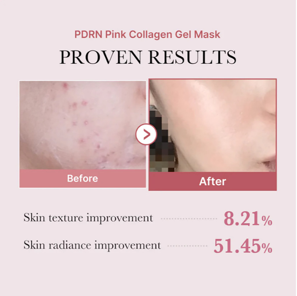 Medicube PDRN Pink Collagen Gel Mask - 28g - Image 3